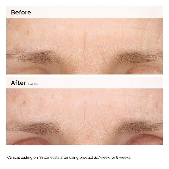 The Ordinary  Retinal 0.2% Emulsion Serum image 2