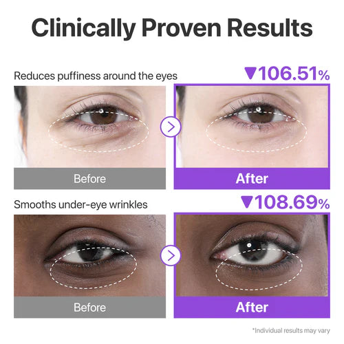 numbuzin No.9 NAD+ Collagen Under Eye Patches 5 Pairs | Parches para Imperfecciones