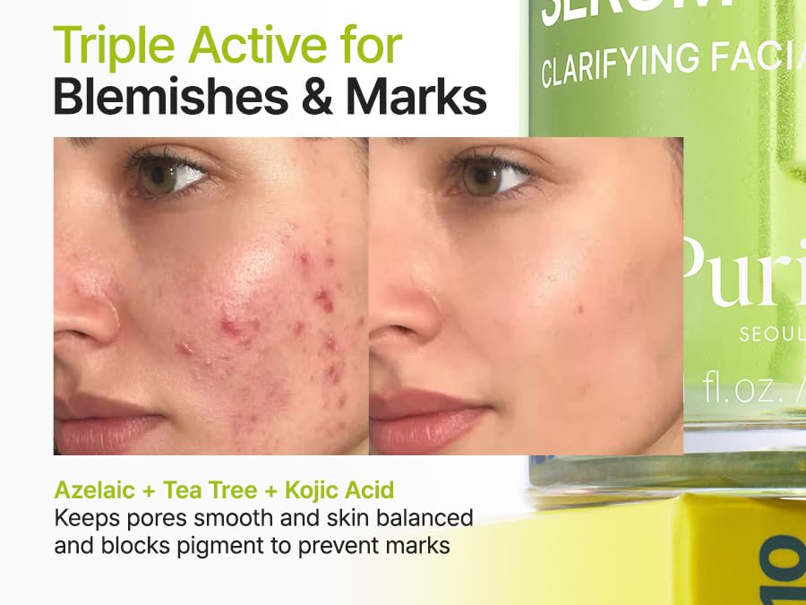 PURITO Azelaic Acid 10% + Kojic Acid + Tea Tree Serum | Sérum Iluminador