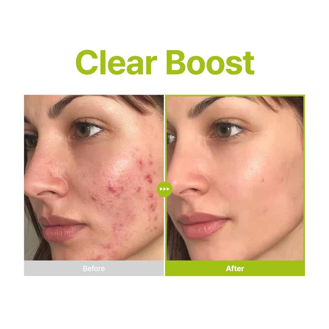 PURITO Azelaic Acid 10% + Kojic Acid + Tea Tree Serum | Sérum Iluminador