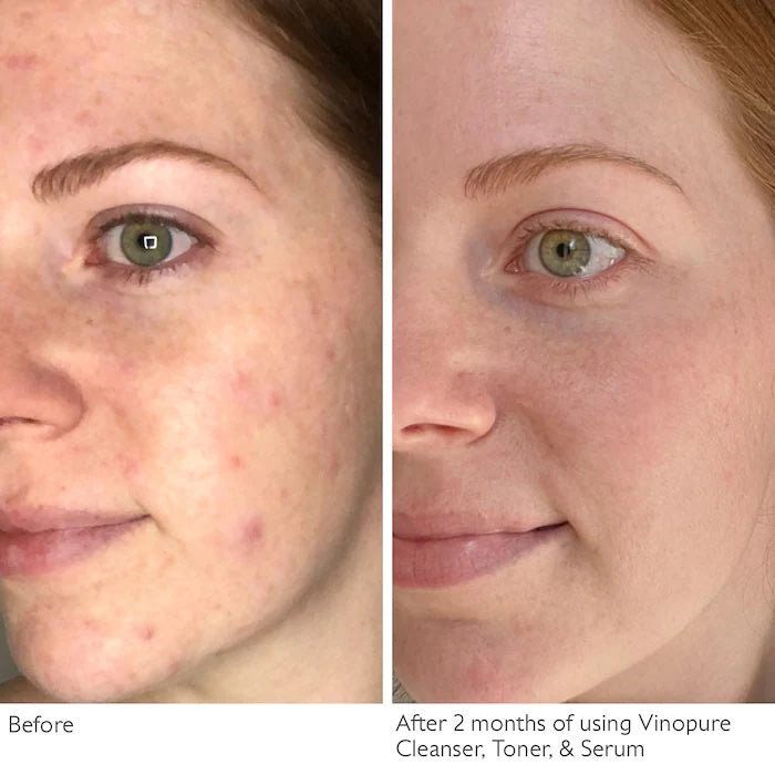 Caudalie
Vinopure Natural Salicylic Acid Pore Minimizing Toner image 1