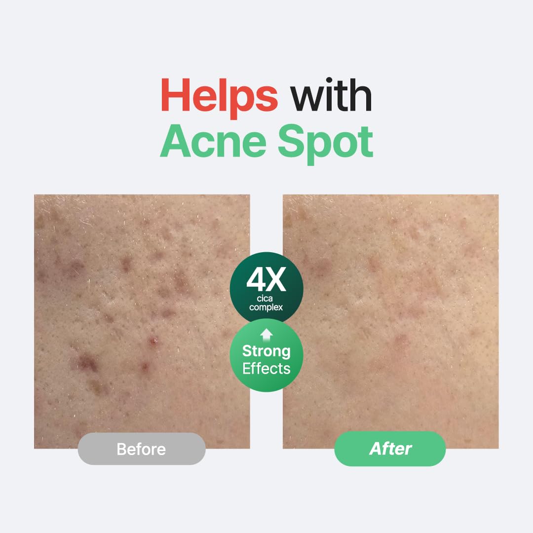 PURITO Wonder Releaf Centella Unscented Serum — Sérum Calmante sin Fragancia con Centella Asiática 60 ml