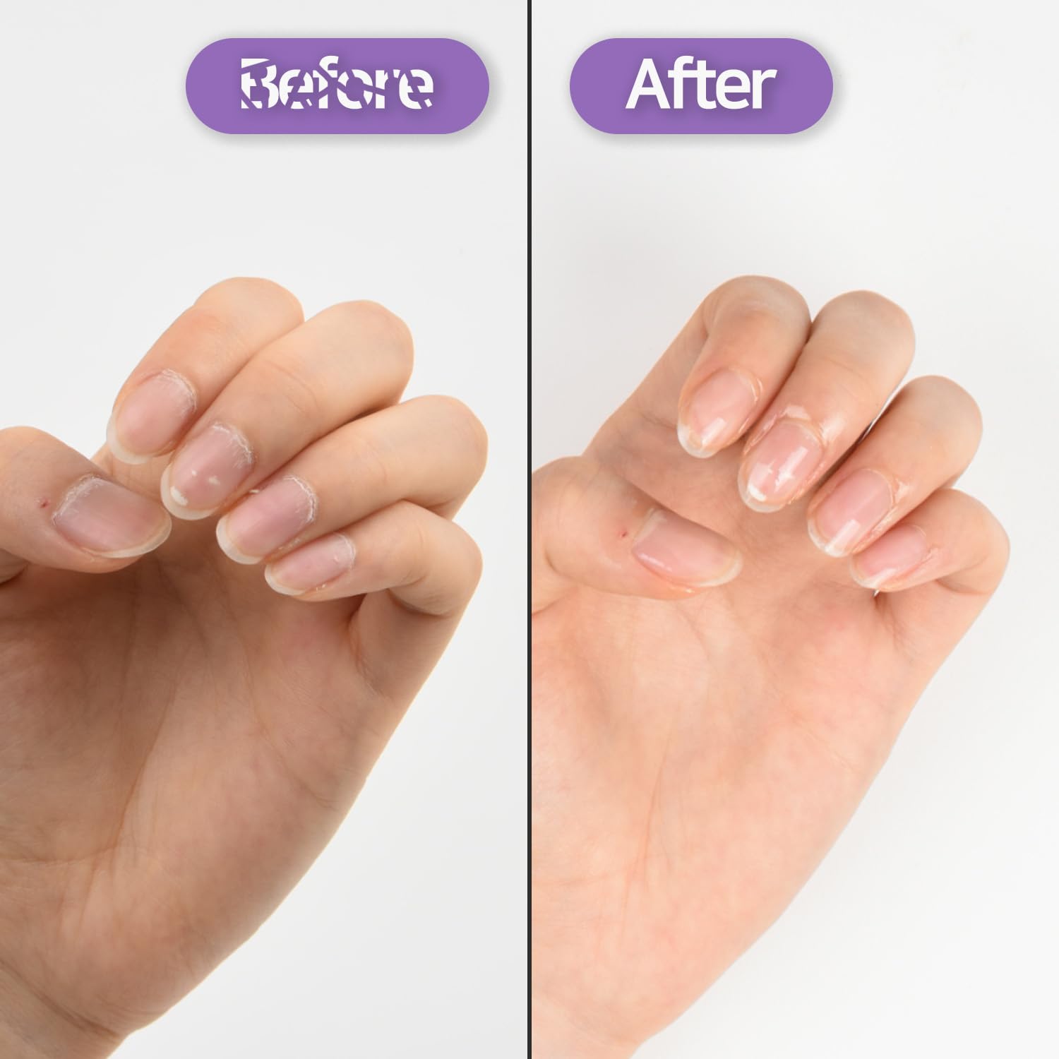 Baren Nail and Cuticle Care Essence Oil Pen — Aceite Esencial en Pluma para Uñas y Cutículas