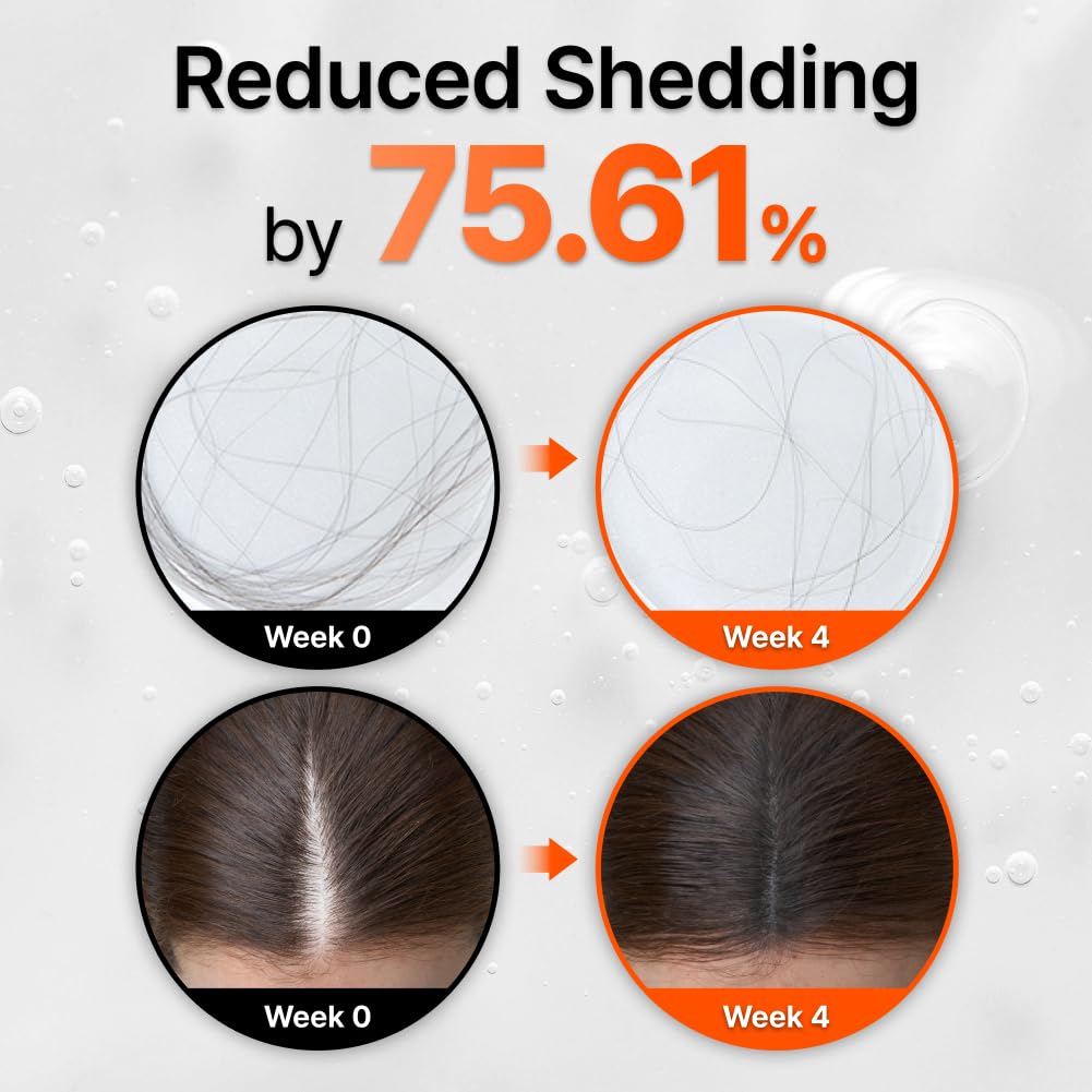 ilso Mini Grow:Turn Exosome Brush Ampoule 30 ml – Tratamiento Revitalizante Para Cuero Cabelludo