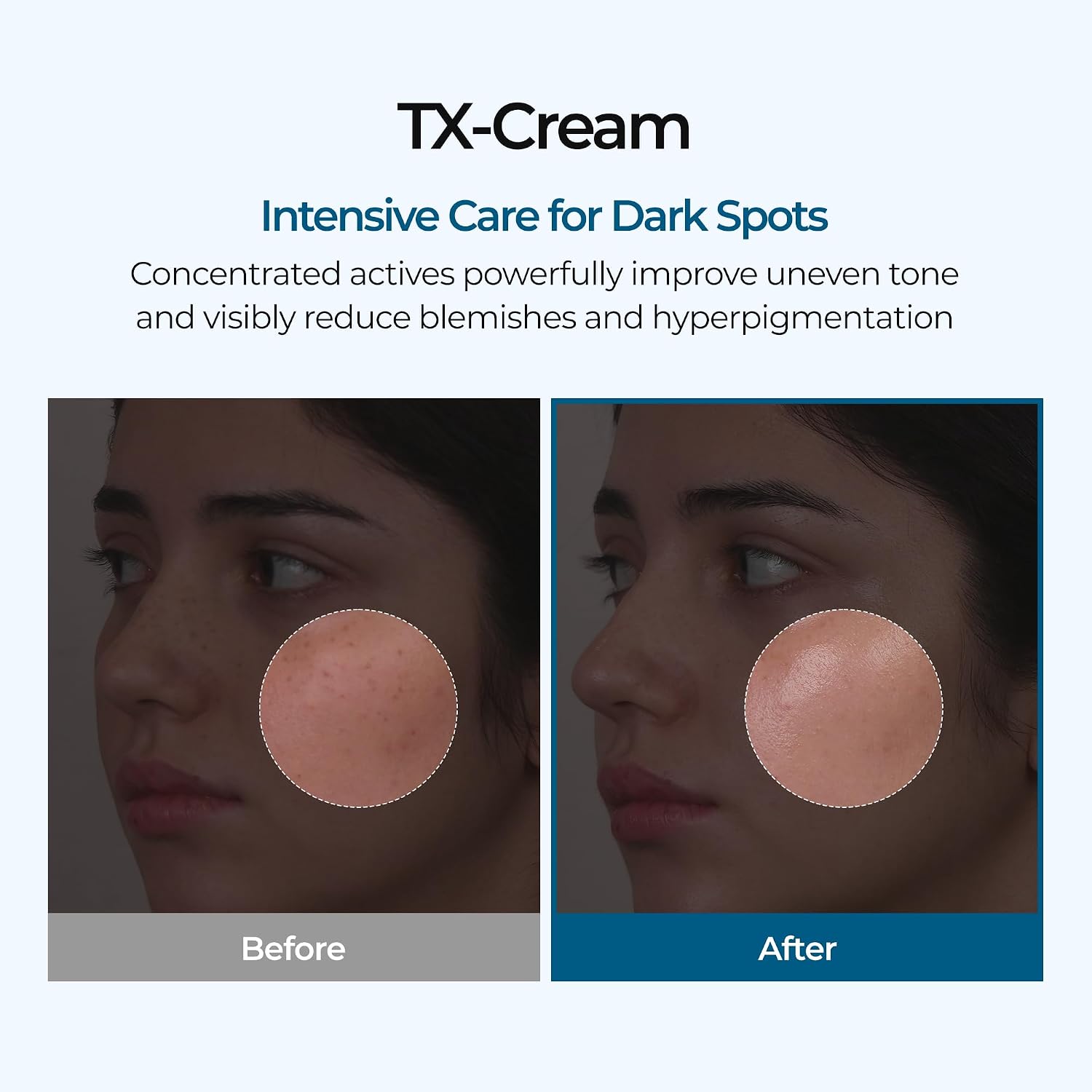 Dr. Melaxin TX Tranexamic Acid Cream – Crema Iluminadora Con Ácido Tranexámico Y Niacinamida 50 ML