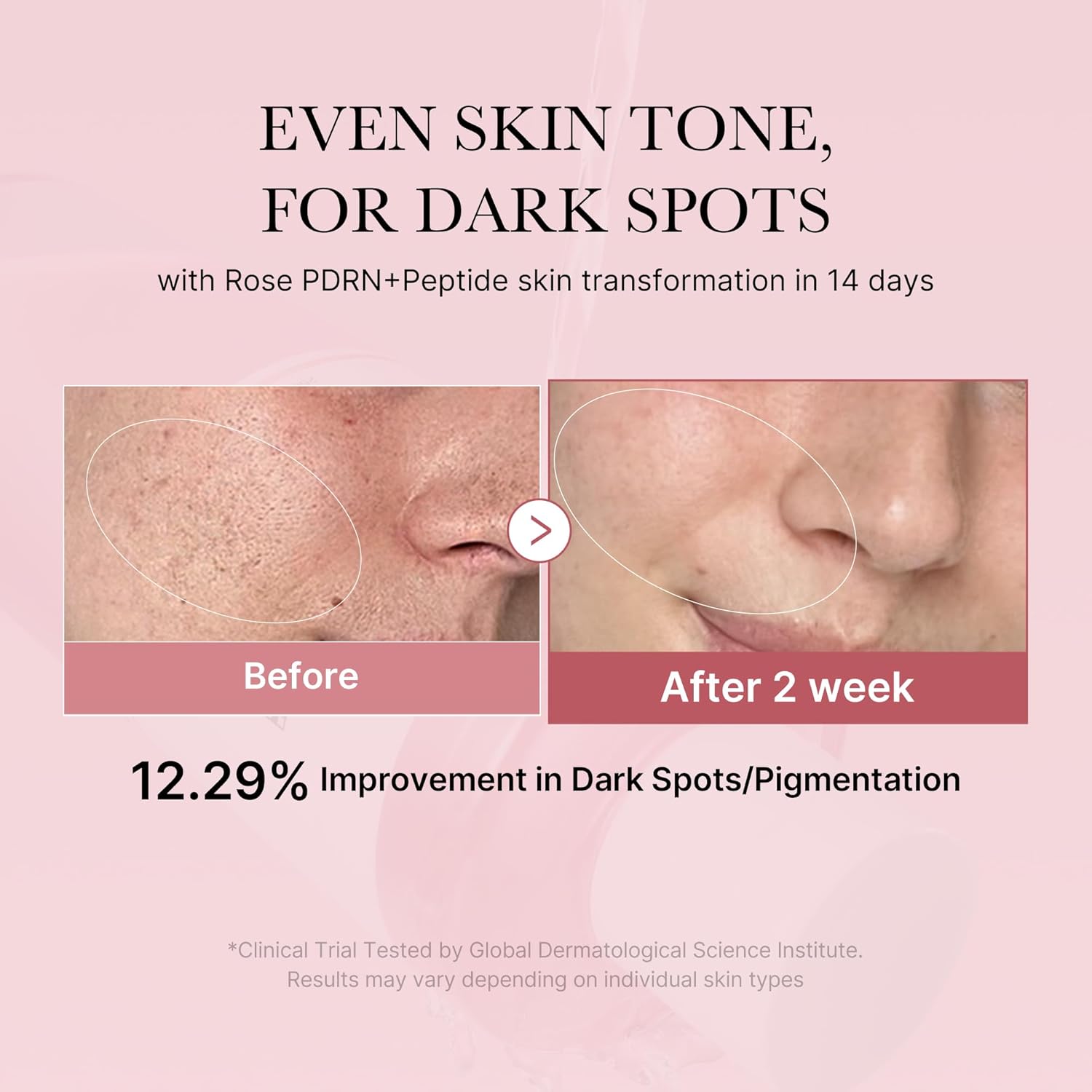 Medicube PDRN Pink Peptide Toner – Tónico Facial Reafirmante e Hidratante