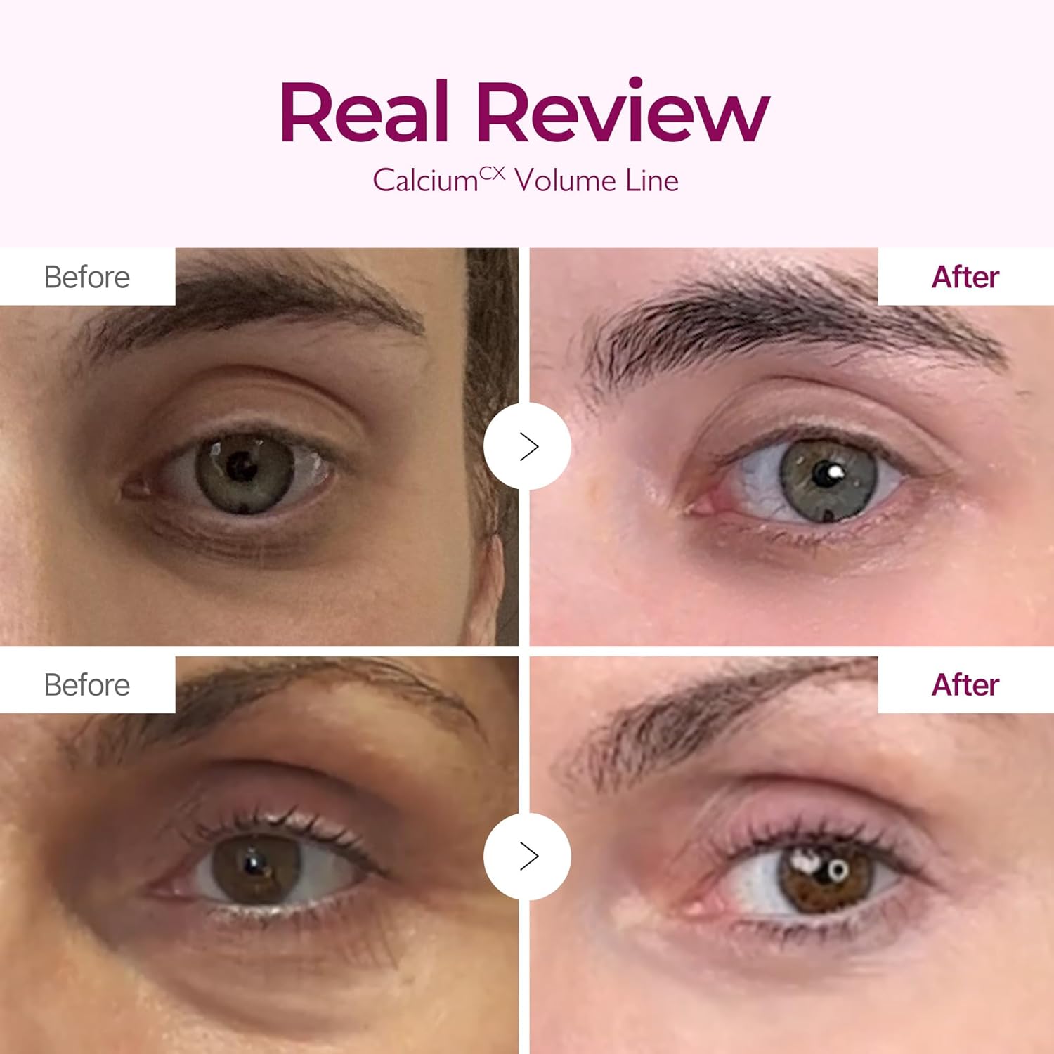 Dr. Melaxin Cemenrete Calcium Collagen Intensive Cream Crema Reafirmante Con Colágeno Y Elastina 50 ml
