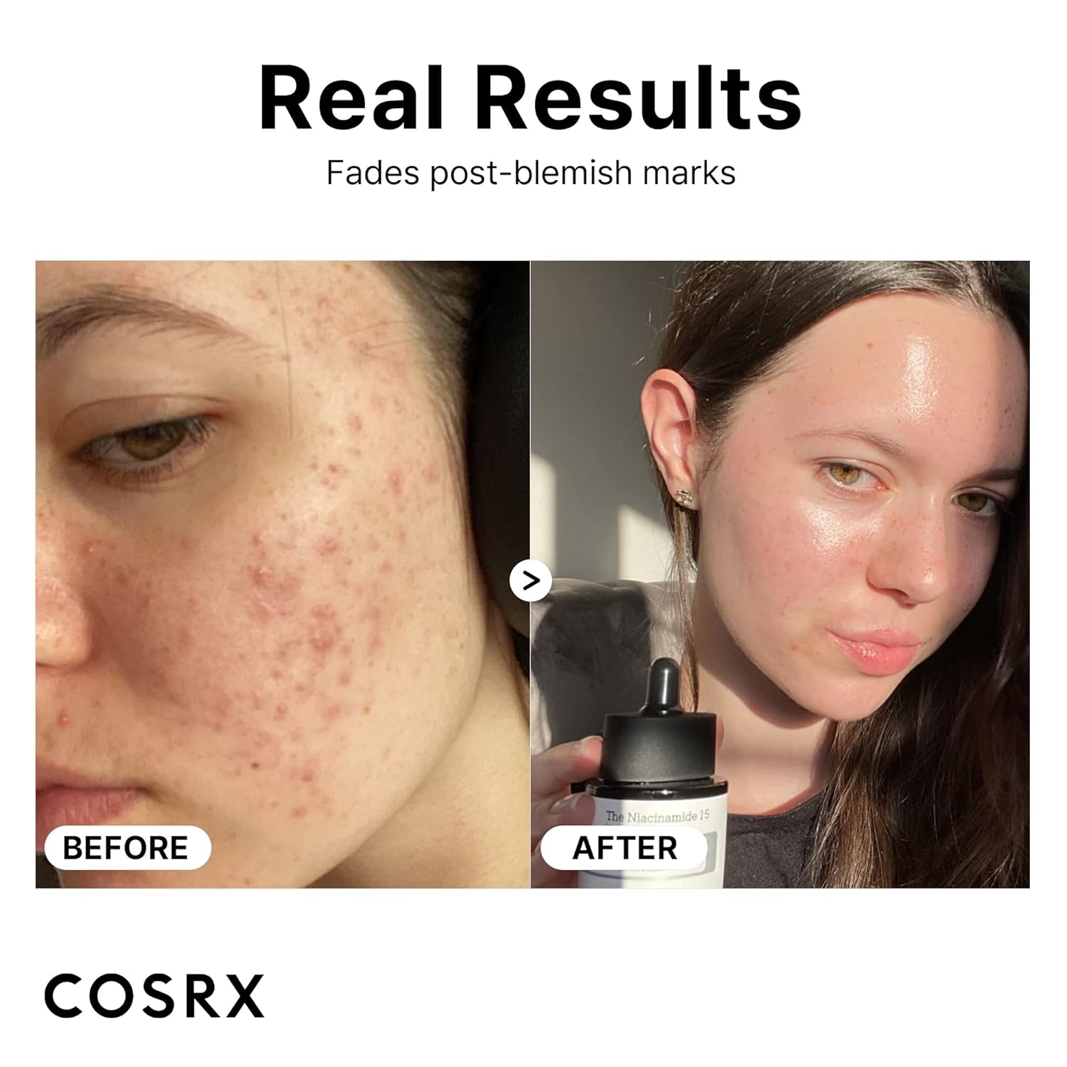 COSRX The Niacinamide 15 Acetyl Glucosamine + Zinc PCA | Suero Antiimperfecciones e Iluminador