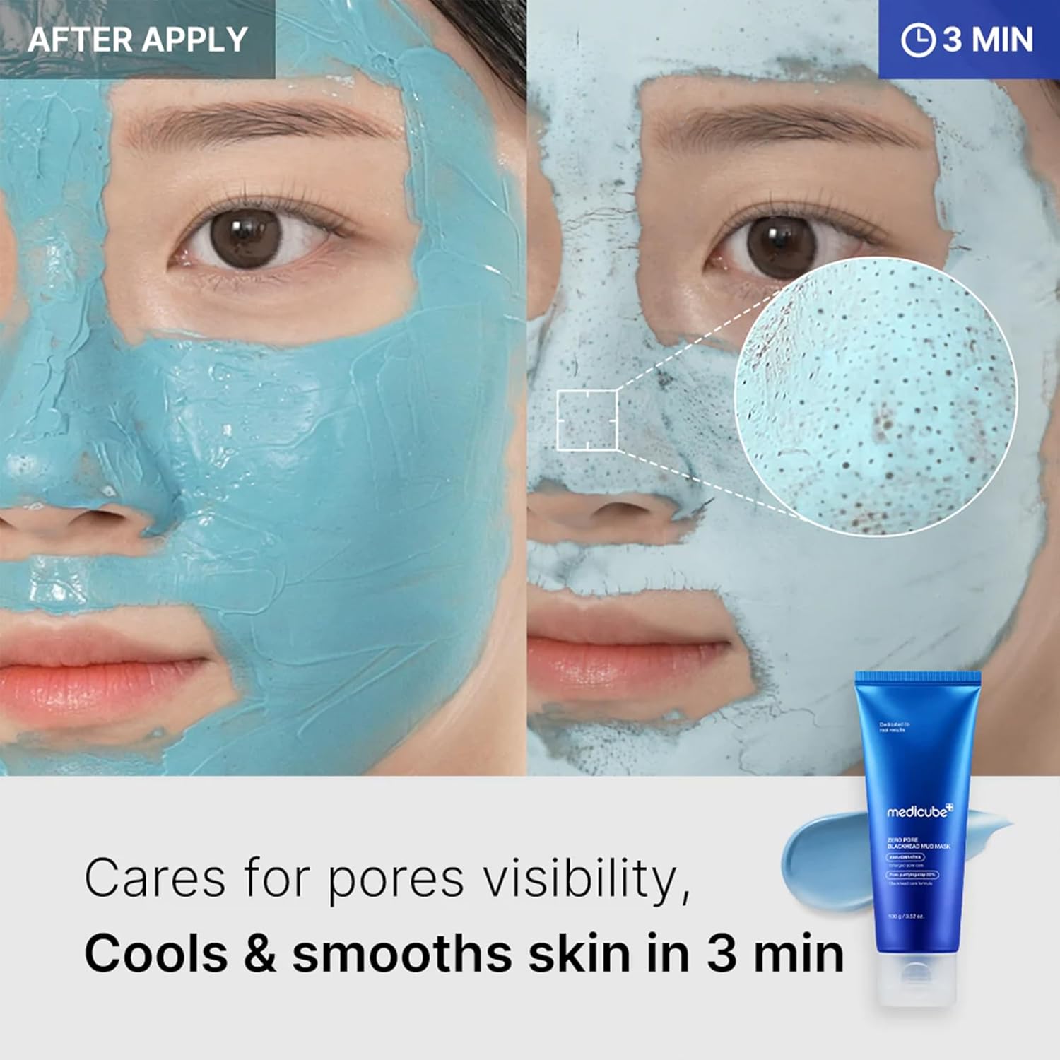 Medicube Máscara Facial De Barro Zero Pore | Limpieza Profunda Y Reducción De Puntos Negros