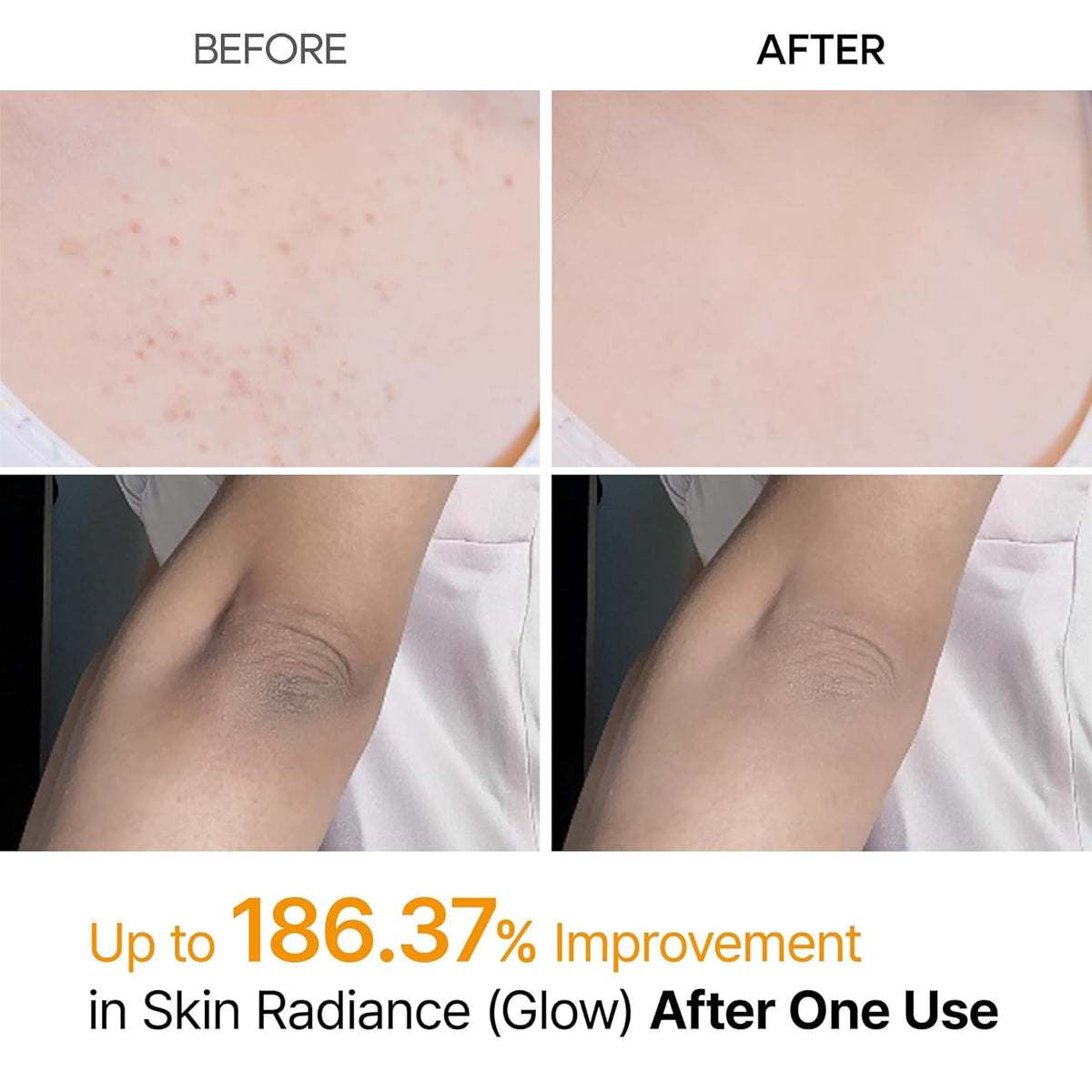 Dr. Melaxin Peel Shot Exfoliating Kojic Acid Turmeric Spray | Exfoliante Facial