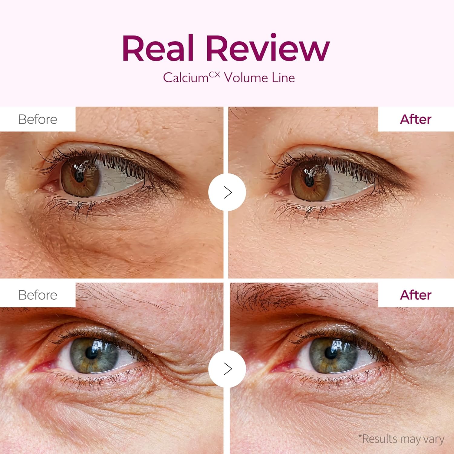 Dr. Melaxin Cemenrete Calcium Volume Eye Patch Parches Para Contorno De Ojos Con Calcio 60 Parches