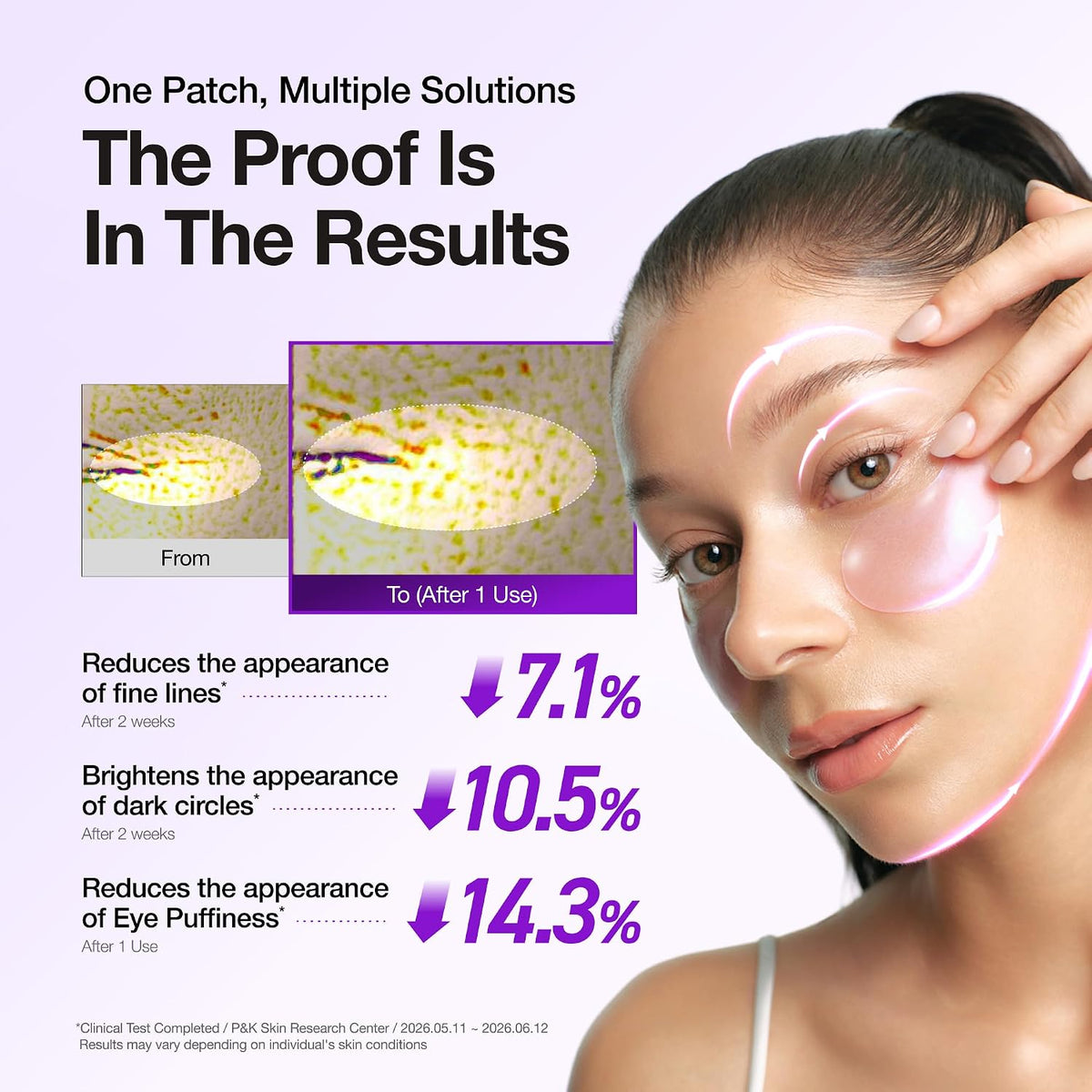 Anua Retinol Berry Revitalizing Eye Patch 83g (60 Parches) – Parches Hidrogel Antiedad Con Retinol Y Arándano