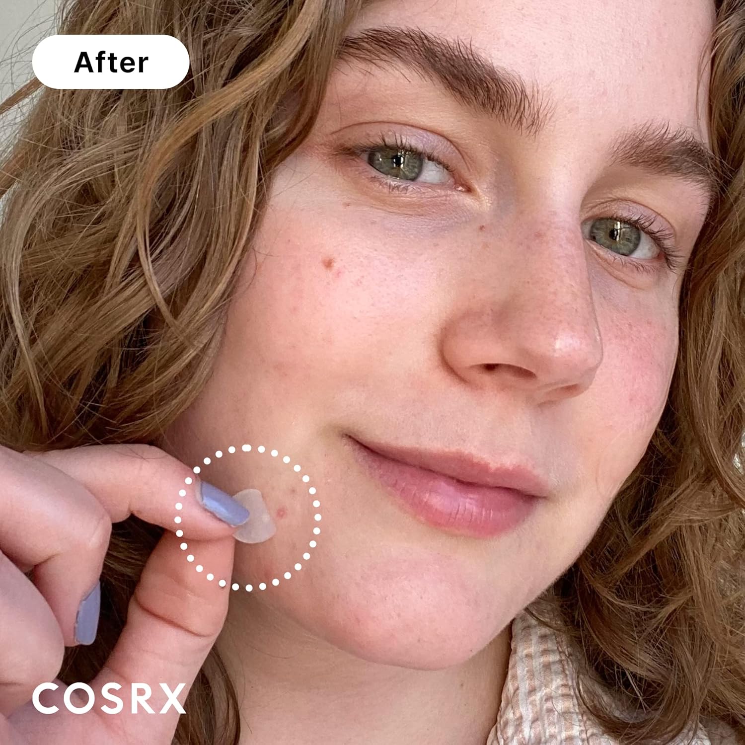 COSRX Acne Pimple Patch – Parche Hidrocoloide Absorbente para Acné