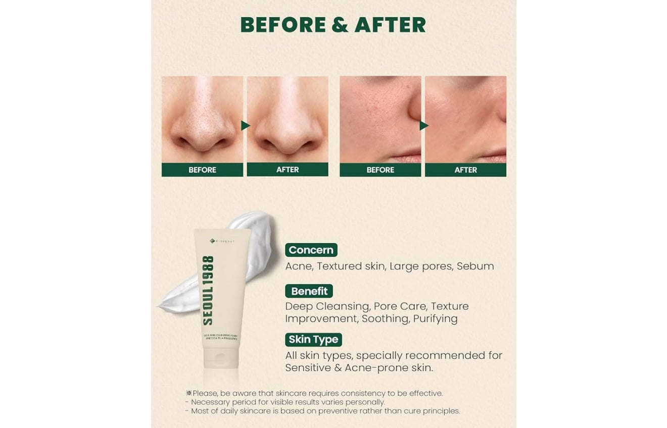SEOUL 1988 Cleansing Foam image 1