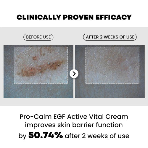 PRO-CALM EGF Active Vital Cream Crema Facial Reparadora Y Reafirmante 20 ml