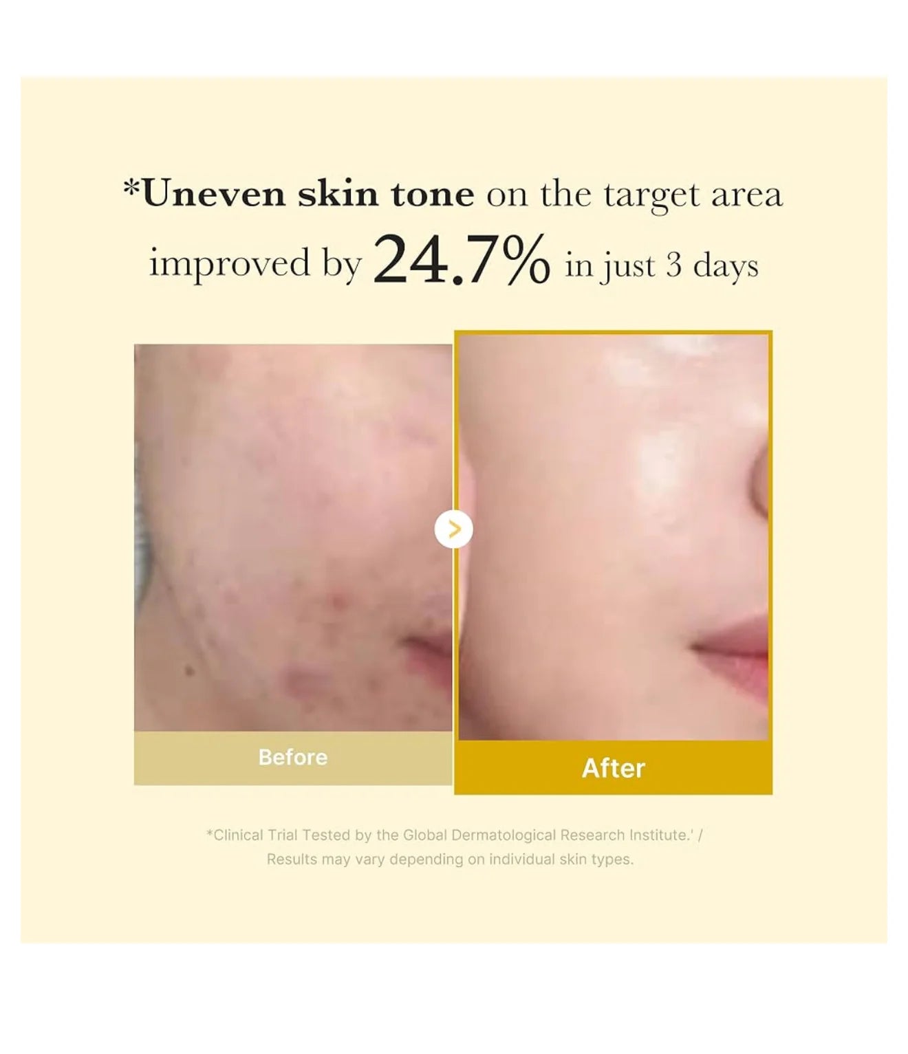 Medicube Kojic Acid Turmeric Night Wrapping Mask | Mascarilla Nocturna Iluminadora Y Reparadora