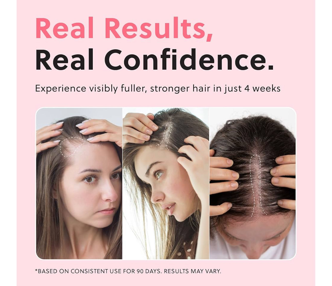 Spray Para El Crecimiento Del Cabello – Tratamiento Fortalecedor Y Anticaída