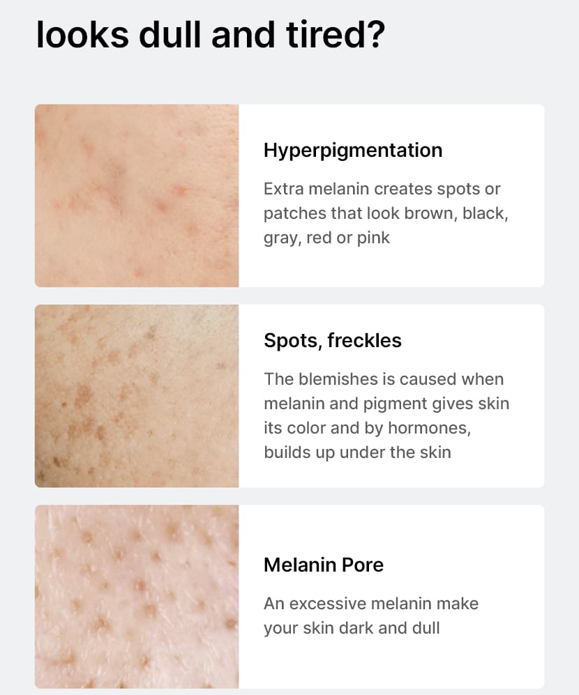 CELIMAX Pore + Dark Spot Kit Set Iluminador Para Poros y Manchas Oscuras