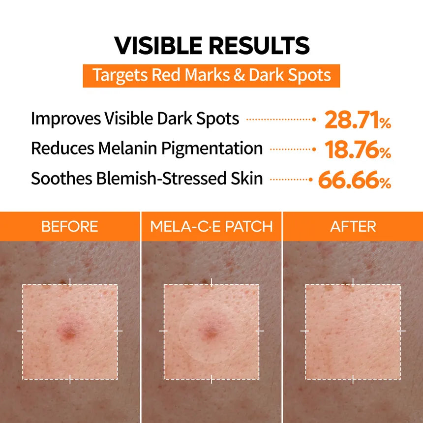 Dr. Melaxin Mela-C·E Zero-Fit Ultra Thin Dark Spot Patch 72 Parches – Parches Invisibles Para Manchas Post-Acné Con Vitamina C Y Ácido Ferúlico