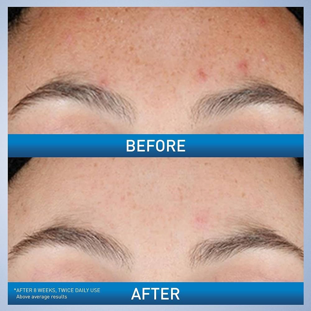 CeraVe Regino serum image 1