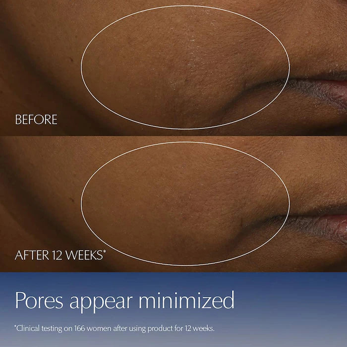 BAJO PEDIDO - Estée Lauder Advanced Night Repair Synchronized Multi-Recovery Complex Serum with Hyaluronic — Suero Antiedad Nocturno Con Ácido Hialurónico Y Tecnología De Reparación Avanzada