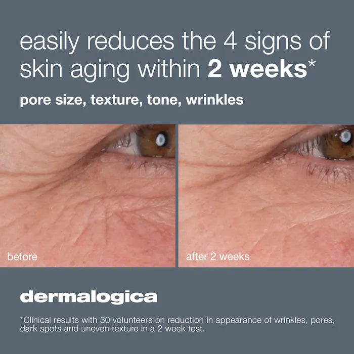 BAJO PEDIDO - Dermalogica Dynamic Skin Retinol Serum – Suero Antiedad Con Retinol Para Piel Firme Y Radiante