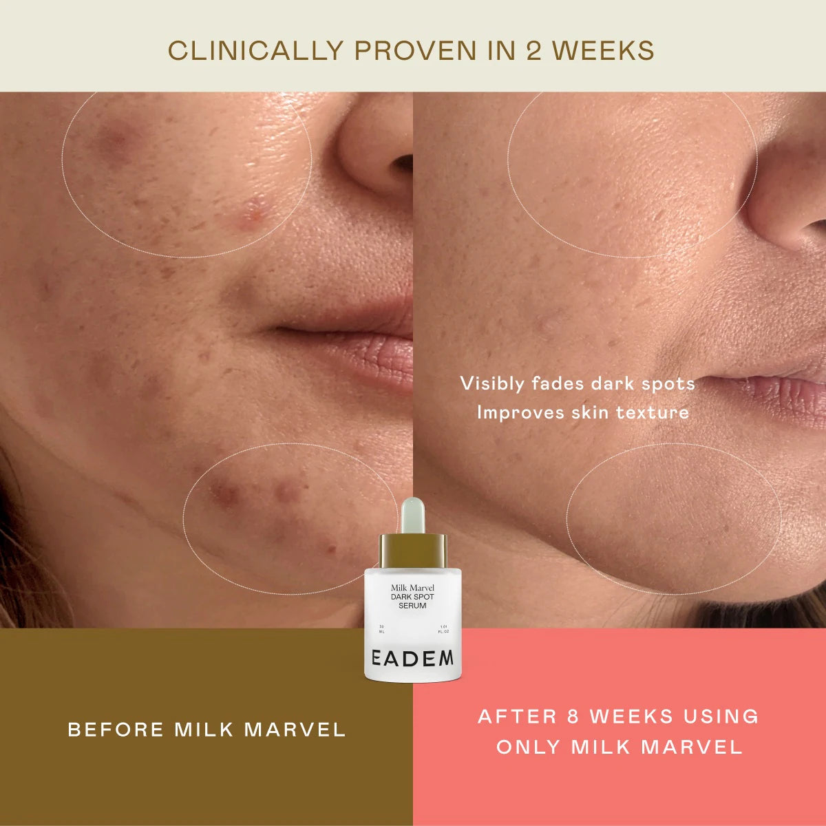 BAJO PEDIDO - EADEM Milk Marvel Dark Spot Serum | Sérum Antimanchas Con Niacinamida
