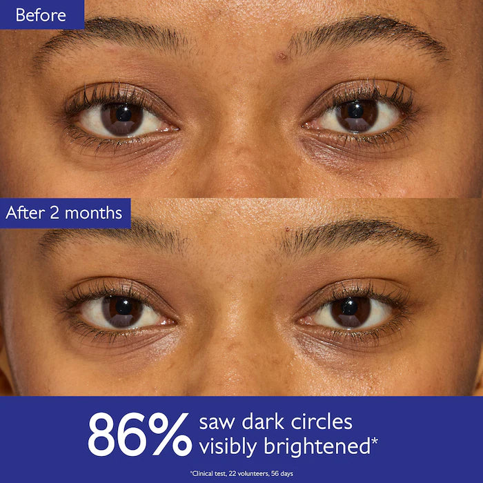 BAJO PEDIDO - Caudalie Vinoperfect Brightening Eye Cream – Crema Iluminadora Para Ojeras Con Niacinamida 15 ML
