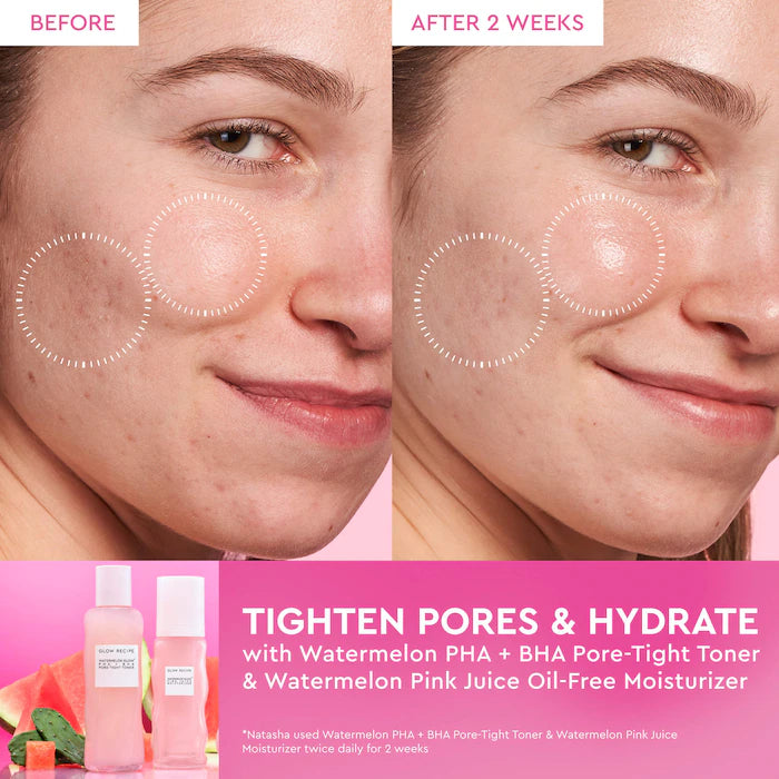 BAJO PEDIDO - Glow Recipe Watermelon Pink Juice Oil-Free Moisturizer Crema Hidratante Ligera Refillable 50 ml