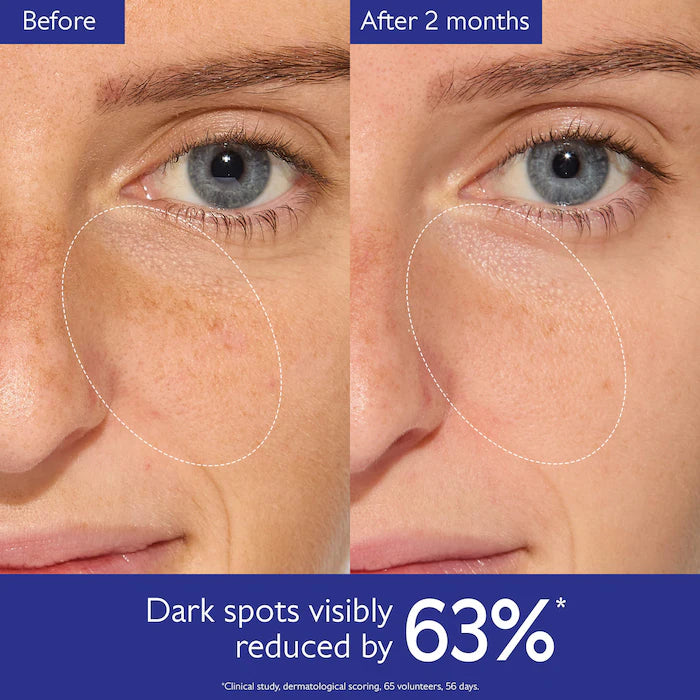 BAJO PEDIDO - Caudalie Vinoperfect Brightening Dark Spot Serum – Suero Antimanchas Iluminador Con Alternativa A La Vitamina C