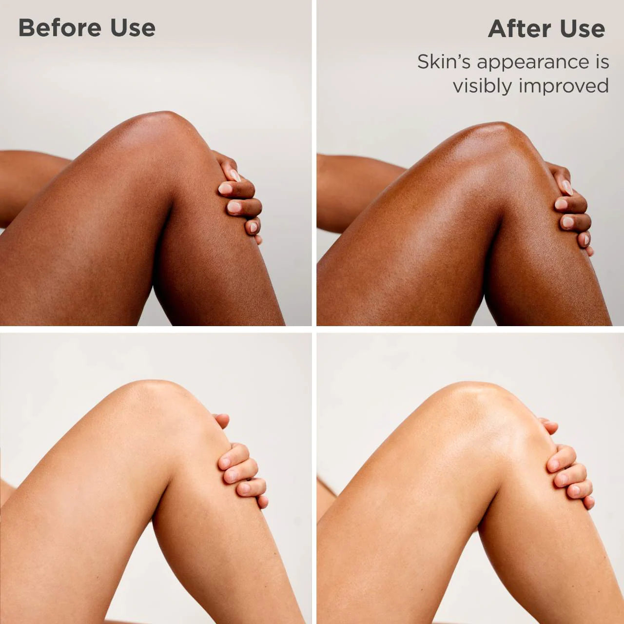 BAJO PEDIDO - ISDIN Uradin Lotion 10 Hydrating Body Lotion for Dry Skin | Loción Corporal