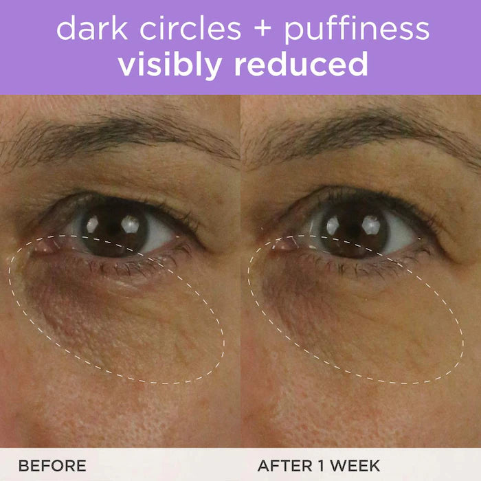 SALE BAJO PEDIDO - Tatcha The Brightening Eye Cream with Vitamin C — Crema Iluminadora Para Ojos Con Vitamina C Que Reduce Ojeras Y Aporta Luminosidad 15 ML