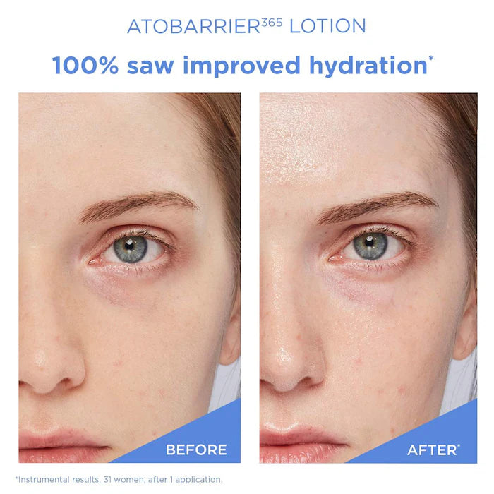 BAJO PEDIDO - AESTURA ATOBARRIER365 Face Lotion