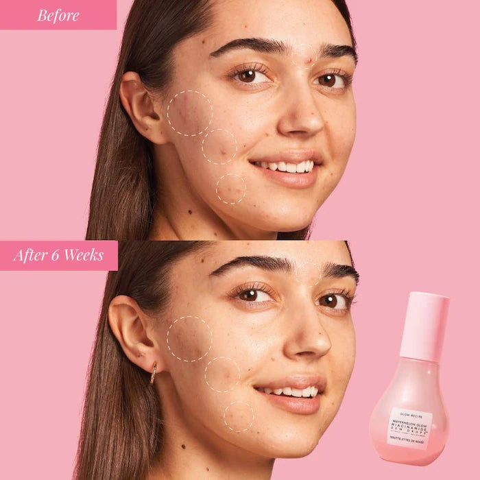 BAJO PEDIDO - Glow Recipe Glow & Go Summer Essentials Kit with Niacinamide Set Esencial de Verano con Niacinamida