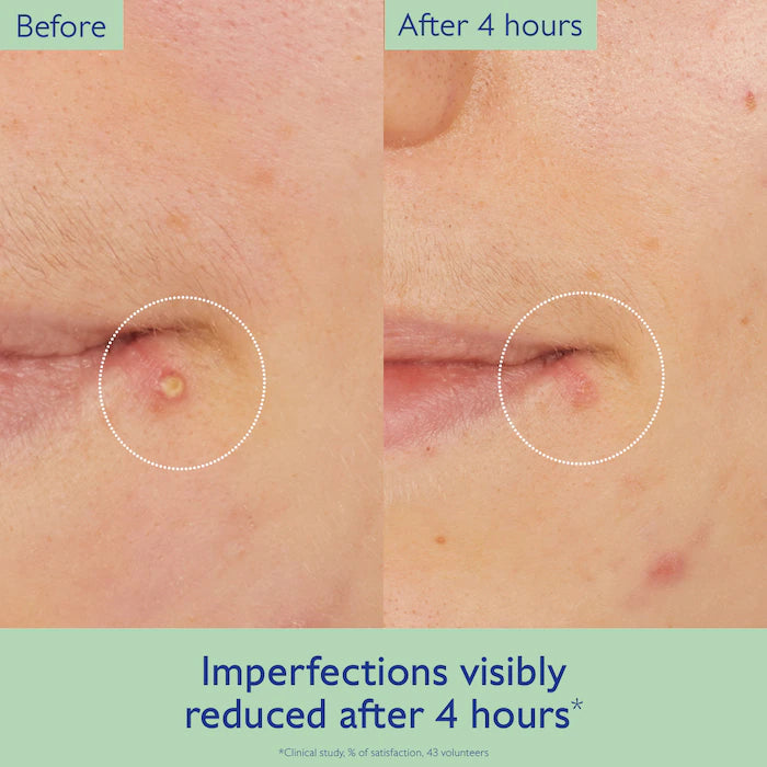 BAJO PEDIDO - Caudalie Vinopure Targeted Spot Solution – Tratamiento Localizado Con Ácido Salicílico Para Imperfecciones 15 ML