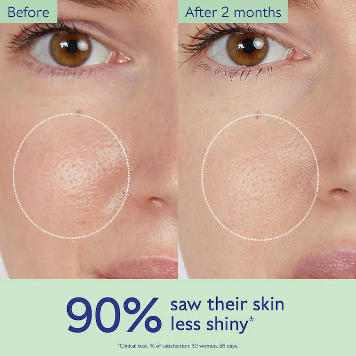 BAJO PEDIDO - Caudalie Vinopure Pore Minimizing Toner – Tónico Con Ácido Salicílico Para Reducir Poros 200 ML