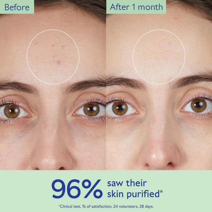BAJO PEDIDO - Caudalie Vinopure Pore Purifying Gel Cleanser – Gel Limpiador Purificante Para Piel Con Imperfecciones 150 ML