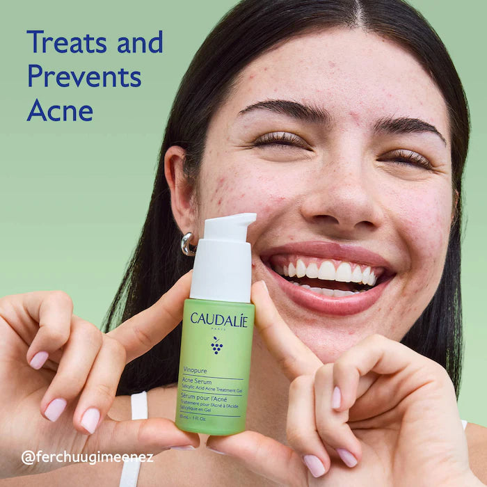 BAJO PEDIDO - Caudalie Vinopure Acne Serum 30 mL – Suero Antiacné Para Tratar Y Prevenir Imperfecciones