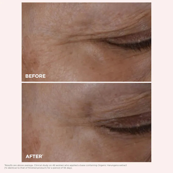 BAJO PEDIDO - Clarins Total Eye Lift – Crema Reafirmante Para Ojos Contra Arrugas, Ojeras Y Bolsas 15 ML