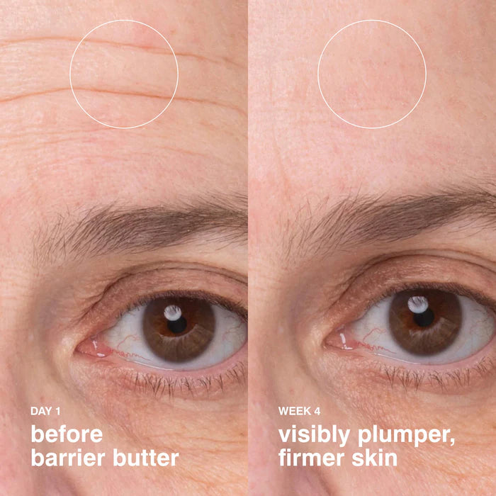BAJO PEDIDO - Rhode Barrier Butter Balm – Bálsamo Hidratante Intensivo Para Restaurar La Barrera Cutánea 50 ML