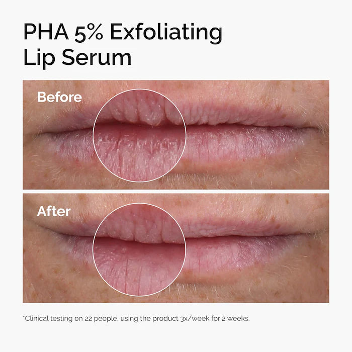 The Ordinary PHA 5% Exfoliating Lip Serum 15 ml | Tratamiento Labial
