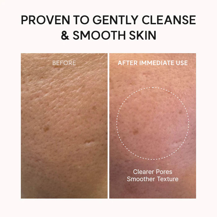 BAJO PEDIDO - Arencia Fresh Rosehip Rice Mochi Cleanser | Limpiador
