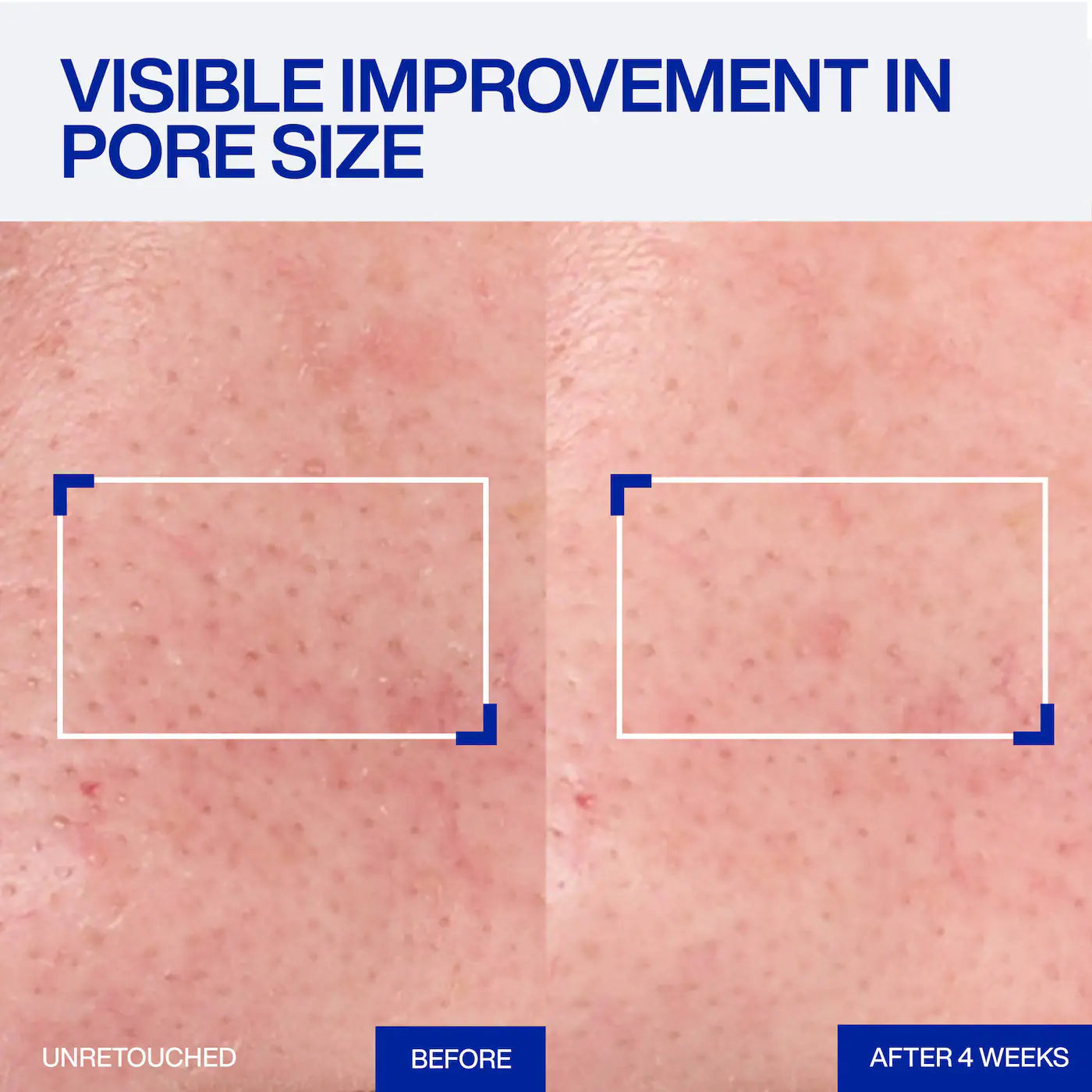 BAJO PEDIDO - IOPE Expert Retinol RX™ 1% Super Bounce Serum for Pore Minimizing | Sérum