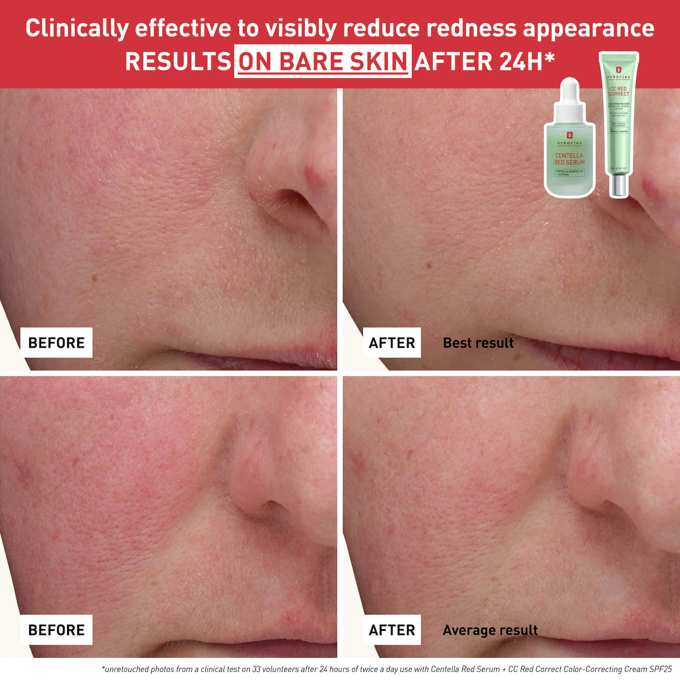 BAJO PEDIDO - Erborian CC Red Correct SPF 25 | CC Cream Verde Anti-Rojeces 45ML