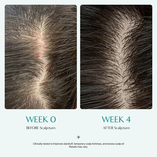 Ilso Scalp:Turn Cica PDRN Brush Ampoule Mini 30 ml | Brocha de Maquillaje